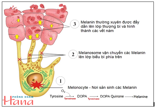 Cơ chế hình thành nám