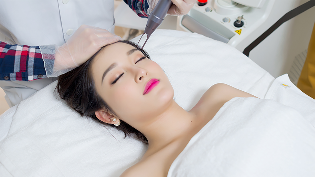 Phương phám trị nám bằng công nghệ laser hiện đại