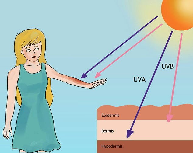 Tại sao muốn hết nám phải chống nắng?